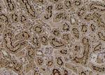 Phospho-MYOD (Thr115) Antibody in Immunohistochemistry (Paraffin) (IHC (P))