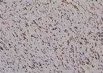 Phospho-IFNGR1 (Tyr457) Antibody in Immunohistochemistry (Paraffin) (IHC (P))