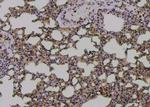 Phospho-IFNGR1 (Tyr457) Antibody in Immunohistochemistry (Paraffin) (IHC (P))