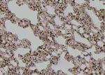 Phospho-IFNGR1 (Tyr457) Antibody in Immunohistochemistry (Paraffin) (IHC (P))