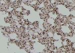 Phospho-FER (Tyr497) Antibody in Immunohistochemistry (Paraffin) (IHC (P))