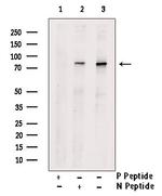 Phospho-PKC alpha (Tyr365) Antibody in Western Blot (WB)