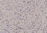 Phospho-JunB (Ser259) Antibody in Immunohistochemistry (Paraffin) (IHC (P))