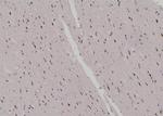 Phospho-JunB (Ser259) Antibody in Immunohistochemistry (Paraffin) (IHC (P))