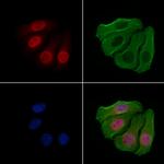 Phospho-JunD (Ser259) Antibody in Immunocytochemistry (ICC/IF)