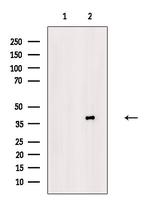 Phospho-PKA alpha/beta/gamma (Thr198) Antibody in Western Blot (WB)