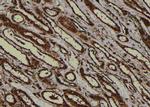 Phospho-PKA alpha/beta/gamma (Thr198) Antibody in Immunohistochemistry (Paraffin) (IHC (P))