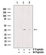 Phospho-C/EBP beta (Ser76) Antibody in Western Blot (WB)