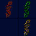 Phospho-JAK1 (Tyr1125) Antibody in Immunocytochemistry (ICC/IF)