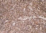 Phospho-JAK1 (Tyr1125) Antibody in Immunohistochemistry (Paraffin) (IHC (P))