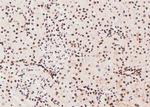 Phospho-JAK1 (Tyr1125) Antibody in Immunohistochemistry (Paraffin) (IHC (P))