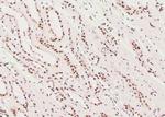 Phospho-RNA pol II CTD (Tyr145) Antibody in Immunohistochemistry (Paraffin) (IHC (P))