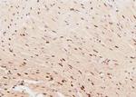 Phospho-RNA pol II CTD (Tyr145) Antibody in Immunohistochemistry (Paraffin) (IHC (P))