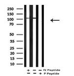 Phospho-EphA2 (Tyr588) Antibody in Western Blot (WB)