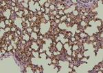 Phospho-EphA2 (Tyr594) Antibody in Immunohistochemistry (Paraffin) (IHC (P))