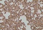 Phospho-EphA2 (Ser901) Antibody in Immunohistochemistry (Paraffin) (IHC (P))