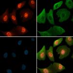 Phospho-MCM4 (Ser88) Antibody in Immunocytochemistry (ICC/IF)