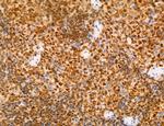 Phospho-FLT3 (Tyr631) Antibody in Immunohistochemistry (Paraffin) (IHC (P))