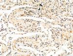 Phospho-FLT3 (Tyr631) Antibody in Immunohistochemistry (Paraffin) (IHC (P))