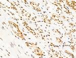 Phospho-FLT3 (Tyr631) Antibody in Immunohistochemistry (Paraffin) (IHC (P))