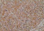 Phospho-SREBP1 (Ser338) Antibody in Immunohistochemistry (Paraffin) (IHC (P))