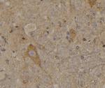 Phospho-SREBP1 (Ser338) Antibody in Immunohistochemistry (Paraffin) (IHC (P))