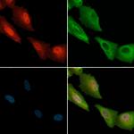 Phospho-SREBP1 (Ser338) Antibody in Immunocytochemistry (ICC/IF)