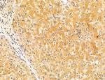 Phospho-SREBP1 (Ser338) Antibody in Immunohistochemistry (Paraffin) (IHC (P))