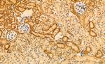 Phospho-SREBP1 (Ser338) Antibody in Immunohistochemistry (Paraffin) (IHC (P))