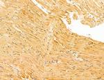 Phospho-SREBP1 (Ser338) Antibody in Immunohistochemistry (Paraffin) (IHC (P))