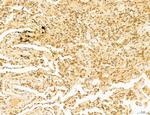 Phospho-SREBP1 (Ser338) Antibody in Immunohistochemistry (Paraffin) (IHC (P))