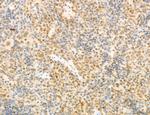 Phospho-GluR1 (Ser836) Antibody in Immunohistochemistry (Paraffin) (IHC (P))