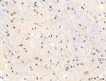 Phospho-GluR1 (Ser836) Antibody in Immunohistochemistry (Paraffin) (IHC (P))