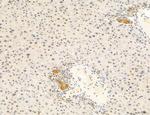 Phospho-mTOR (Ser2454) Antibody in Immunohistochemistry (Paraffin) (IHC (P))