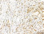 Phospho-mTOR (Ser2454) Antibody in Immunohistochemistry (Paraffin) (IHC (P))
