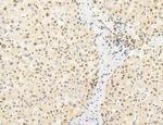 Phospho-mTOR (Ser2454) Antibody in Immunohistochemistry (Paraffin) (IHC (P))