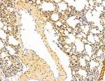 Phospho-mTOR (Ser2454) Antibody in Immunohistochemistry (Paraffin) (IHC (P))