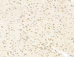 Phospho-mTOR (Ser2454) Antibody in Immunohistochemistry (Paraffin) (IHC (P))