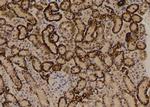 Phospho-mTOR (Ser2454) Antibody in Immunohistochemistry (Paraffin) (IHC (P))