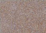 Phospho-CrkL (Tyr251) Antibody in Immunohistochemistry (Paraffin) (IHC (P))