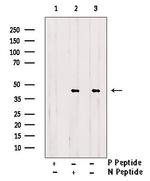 Phospho-CrkL (Tyr251) Antibody in Western Blot (WB)