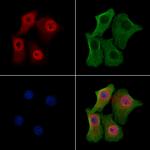 Phospho-BRCA2 (Ser2095) Antibody in Immunocytochemistry (ICC/IF)