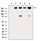 Phospho-BRCA2 (Ser2095) Antibody in Western Blot (WB)