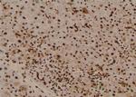 Phospho-BRCA2 (Ser2095) Antibody in Immunohistochemistry (Paraffin) (IHC (P))