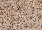 Phospho-RSK2 (Thr577) Antibody in Immunohistochemistry (Paraffin) (IHC (P))