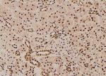 Phospho-RSK2 (Thr577) Antibody in Immunohistochemistry (Paraffin) (IHC (P))