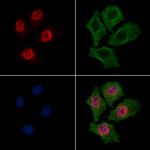 Phospho-RSK2 (Thr577) Antibody in Immunocytochemistry (ICC/IF)