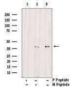 Phospho-Ephrin B2 (Tyr304) Antibody in Western Blot (WB)