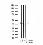 Phospho-Ephrin B2 (Tyr304) Antibody in Western Blot (WB)