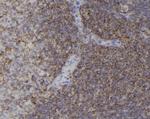 Phospho-Cdc42 (Tyr64) Antibody in Immunohistochemistry (Paraffin) (IHC (P))